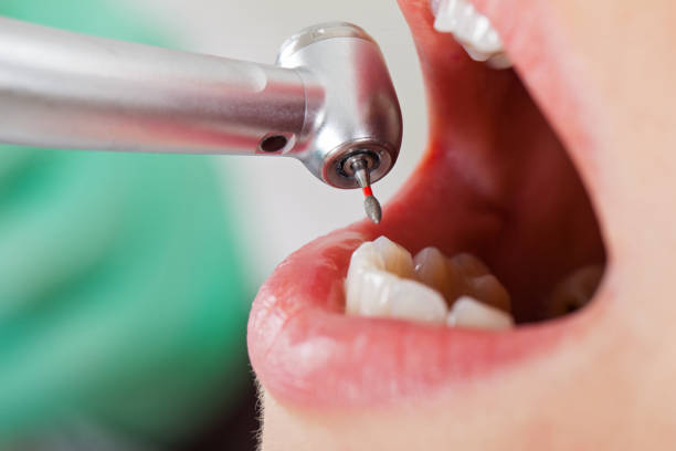 Best After-Hours Dental Trauma Care in Mcnary, AZ